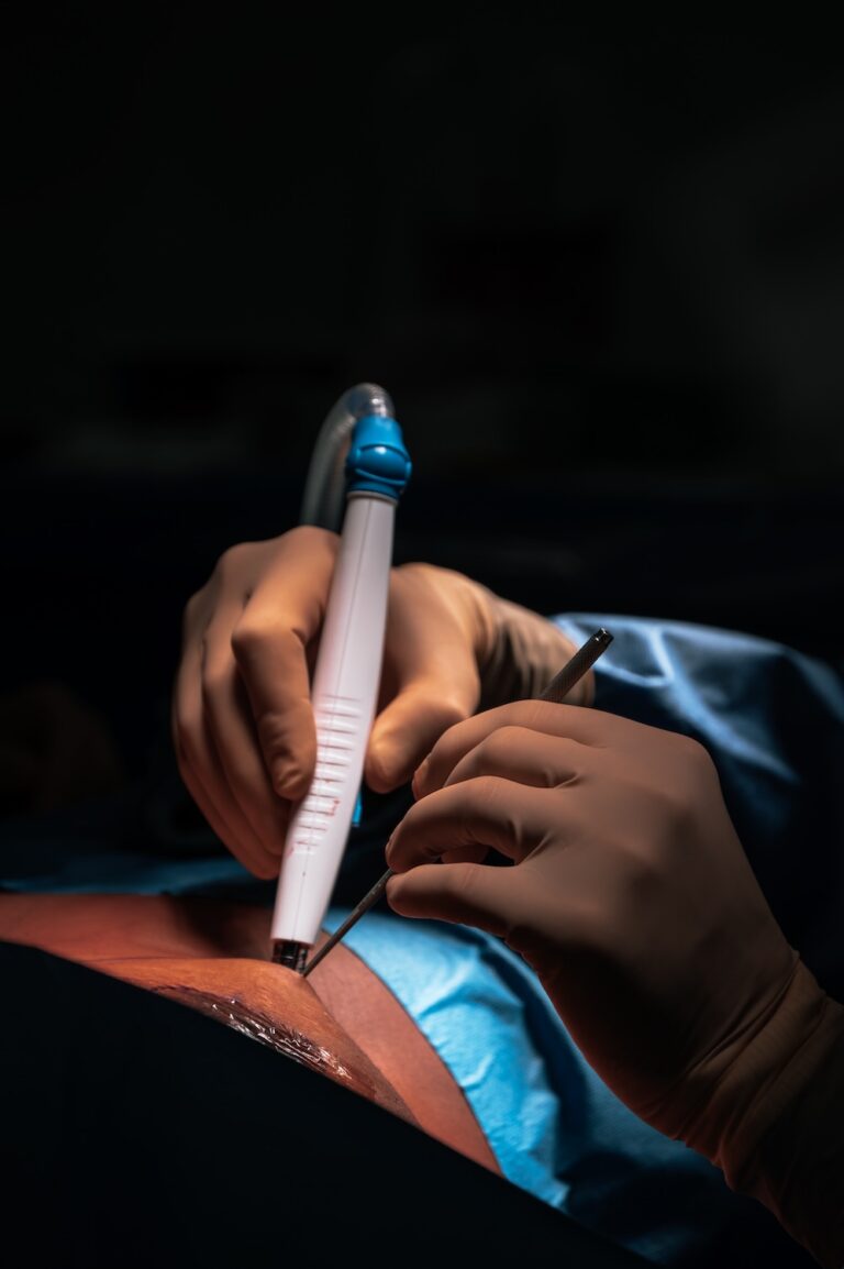 dr-dries-opsomer-plastische-chirurg-44